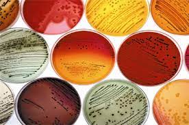 آئوزین متیلن بلو آگار